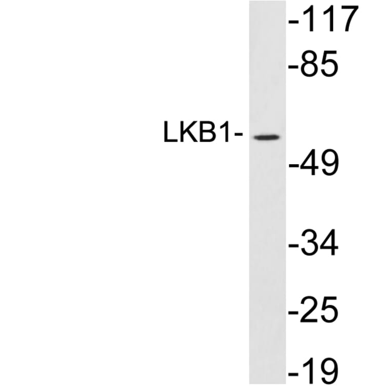 Western Blot - Anti-LKB1 Antibody (R12-2227) - Antibodies.com