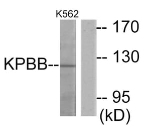 Western Blot - Anti-KPBB Antibody (C11458) - Antibodies.com