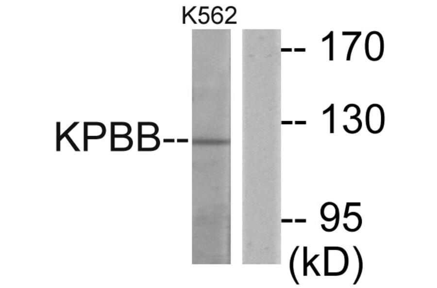 Western Blot - Anti-KPBB Antibody (C11458) - Antibodies.com