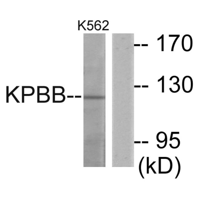 Western Blot - Anti-KPBB Antibody (C11458) - Antibodies.com