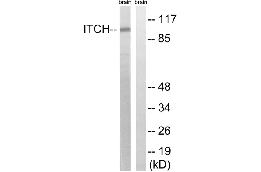 Western Blot - Anti-ITCH Antibody (B8254) - Antibodies.com