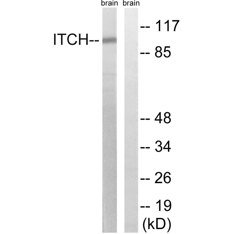 Western Blot - Anti-ITCH Antibody (B8254) - Antibodies.com