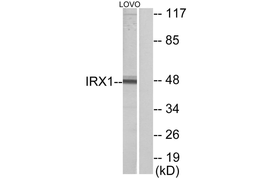Western Blot - Anti-IRX1 Antibody (C10795) - Antibodies.com