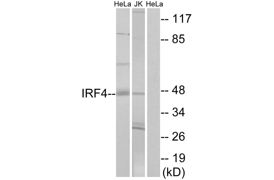 Western Blot - Anti-IRF4 Antibody (C11070) - Antibodies.com