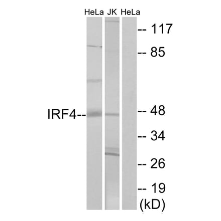 Western Blot - Anti-IRF4 Antibody (C11070) - Antibodies.com