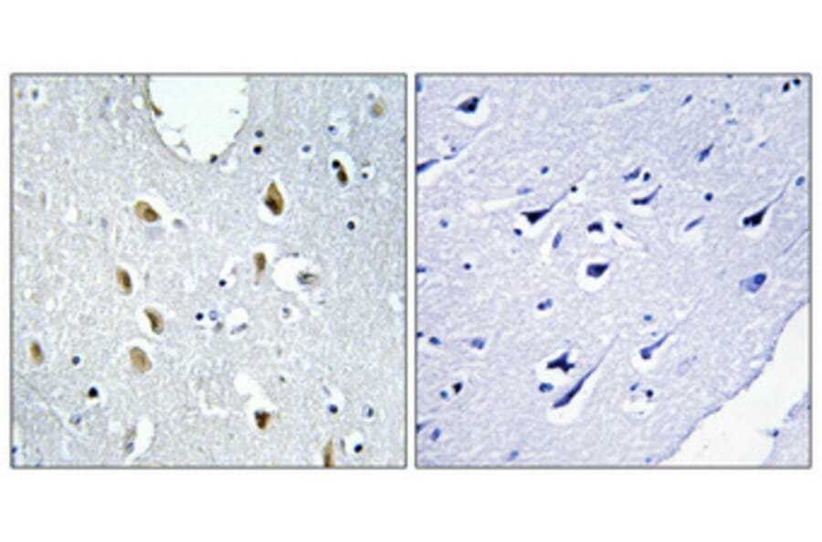 Immunohistochemistry - Anti-IRF4 Antibody (C11070) - Antibodies.com