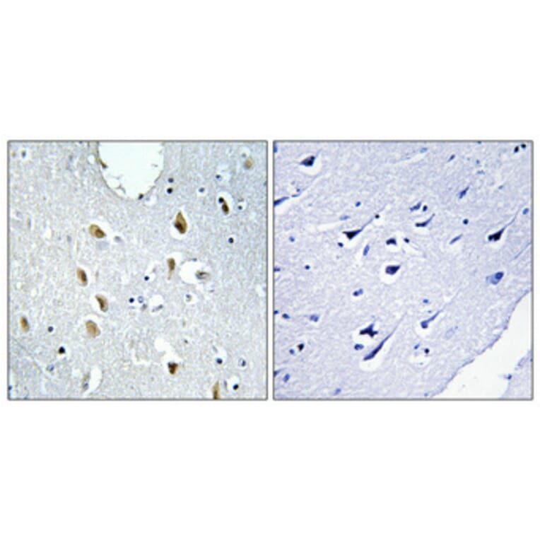 Immunohistochemistry - Anti-IRF4 Antibody (C11070) - Antibodies.com