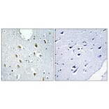 Immunohistochemistry - Anti-IRF4 Antibody (C11070) - Antibodies.com