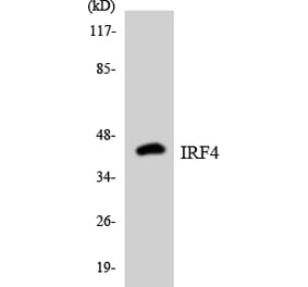 Western Blot - Anti-IRF4 Antibody (R12-2935) - Antibodies.com
