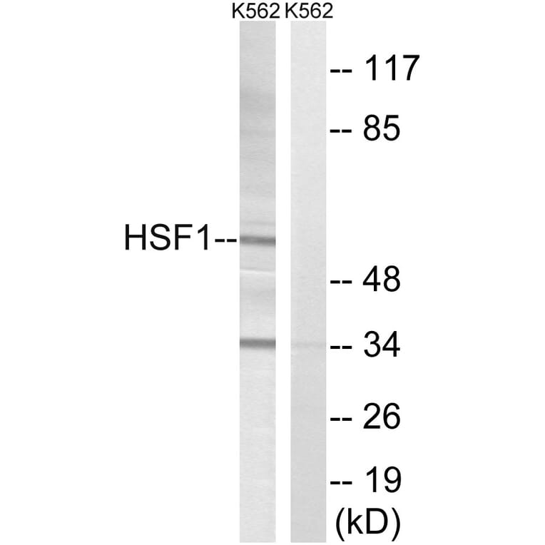 Western Blot - Anti-HSF1 Antibody (B8040) - Antibodies.com
