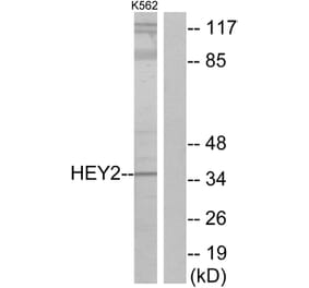 Western Blot - Anti-HEY2 Antibody (C11818) - Antibodies.com