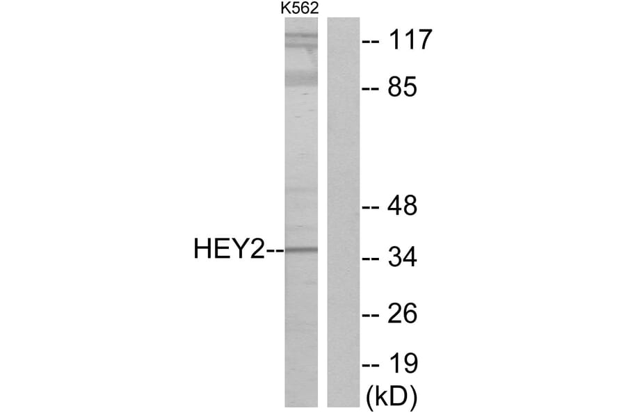 Western Blot - Anti-HEY2 Antibody (C11818) - Antibodies.com
