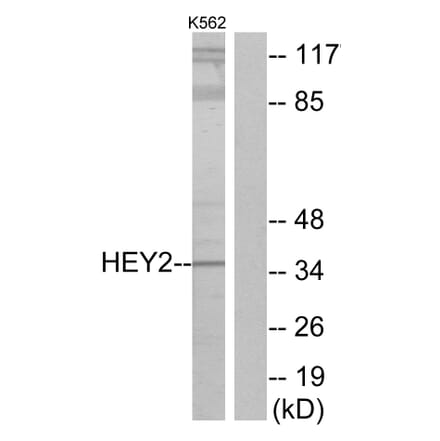 Western Blot - Anti-HEY2 Antibody (C11818) - Antibodies.com