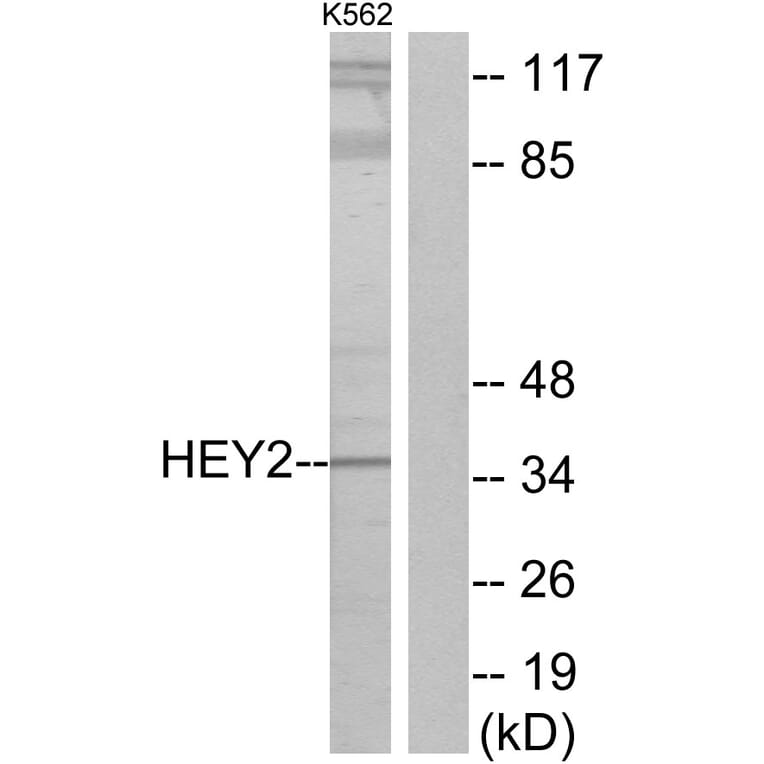 Western Blot - Anti-HEY2 Antibody (C11818) - Antibodies.com