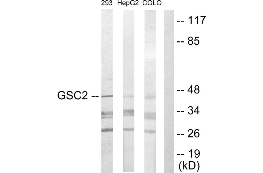 Western Blot - Anti-GSC2 Antibody (C10085) - Antibodies.com