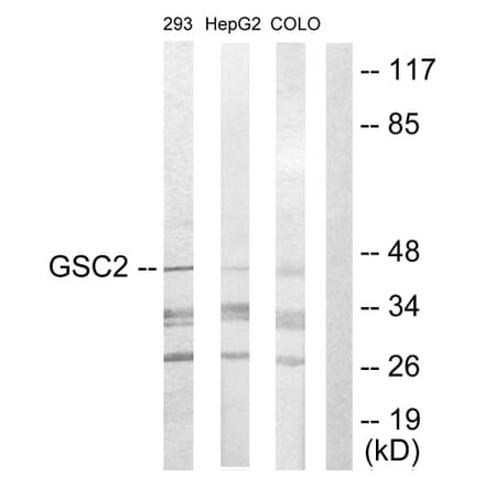 Western Blot - Anti-GSC2 Antibody (C10085) - Antibodies.com