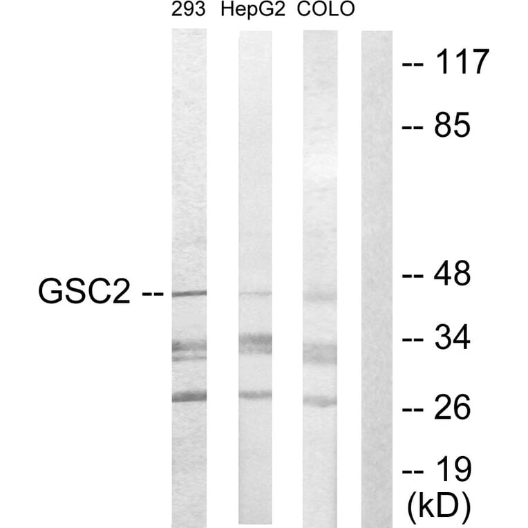 Western Blot - Anti-GSC2 Antibody (C10085) - Antibodies.com