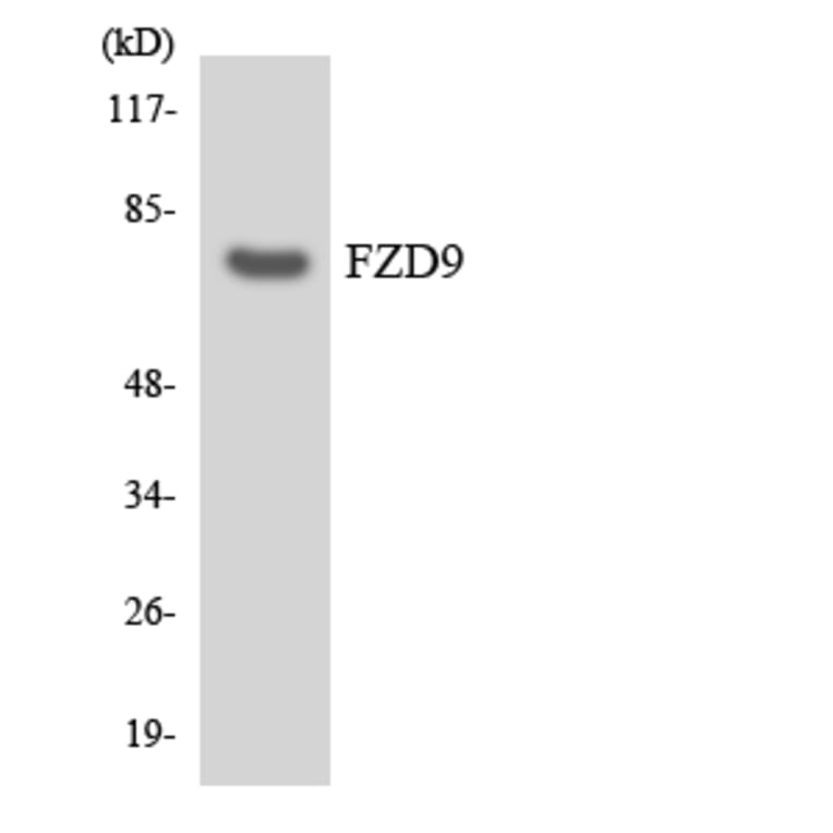 Western Blot - Anti-FZD9 Antibody (R12-2788) - Antibodies.com