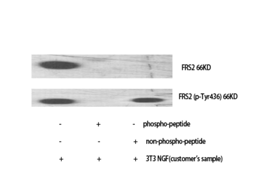 Western Blot - Anti-FRS2 Antibody (B8202) - Antibodies.com