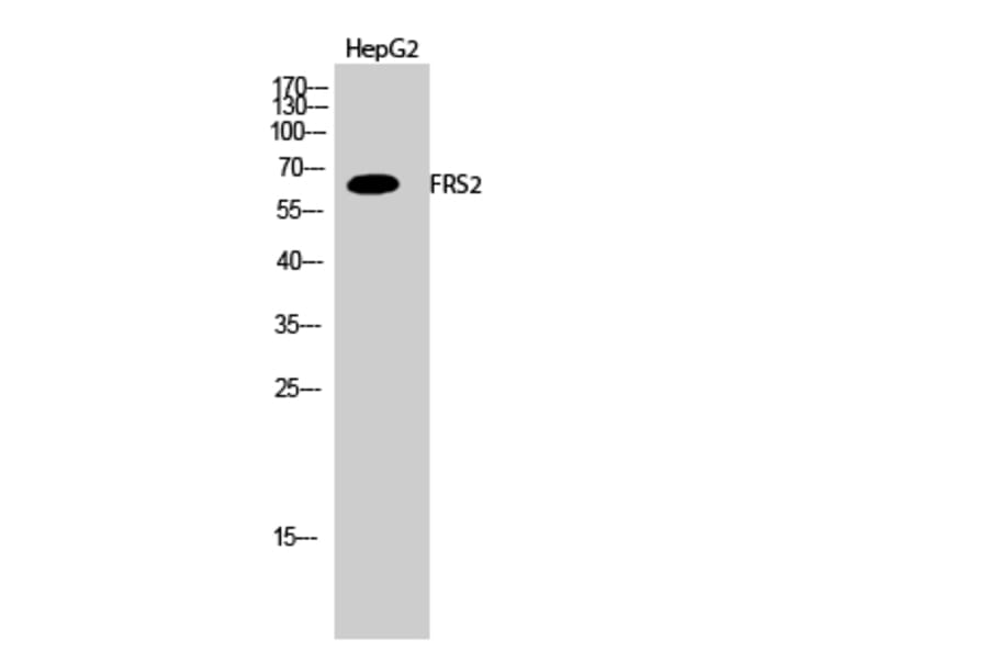 Western Blot - Anti-FRS2 Antibody (B8202) - Antibodies.com