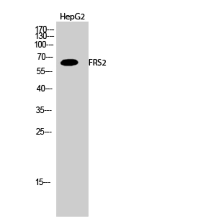 Western Blot - Anti-FRS2 Antibody (B8202) - Antibodies.com