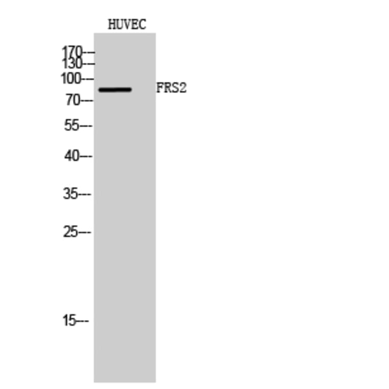 Western Blot - Anti-FRS2 Antibody (B8239) - Antibodies.com