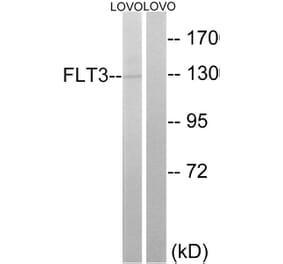 Western Blot - Anti-FLT3 Antibody (B0482) - Antibodies.com