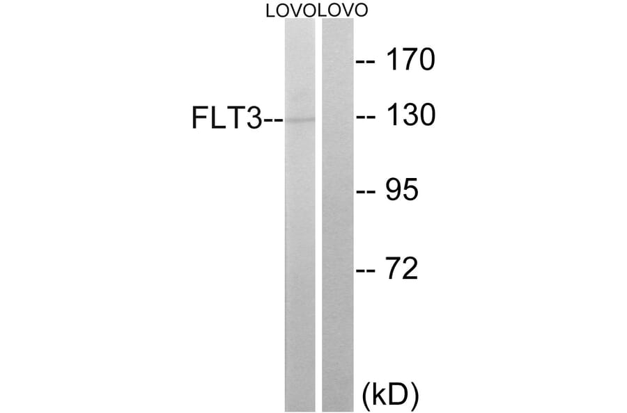 Western Blot - Anti-FLT3 Antibody (B0482) - Antibodies.com