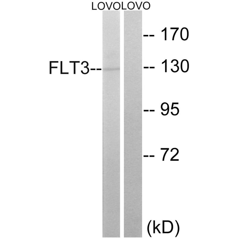 Western Blot - Anti-FLT3 Antibody (B0482) - Antibodies.com