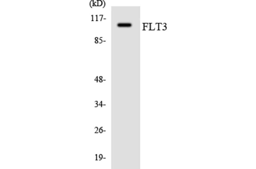 Western Blot - Anti-FLT3 Antibody (R12-2770) - Antibodies.com
