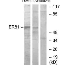 Western Blot - Anti-ER81 Antibody (C10667) - Antibodies.com