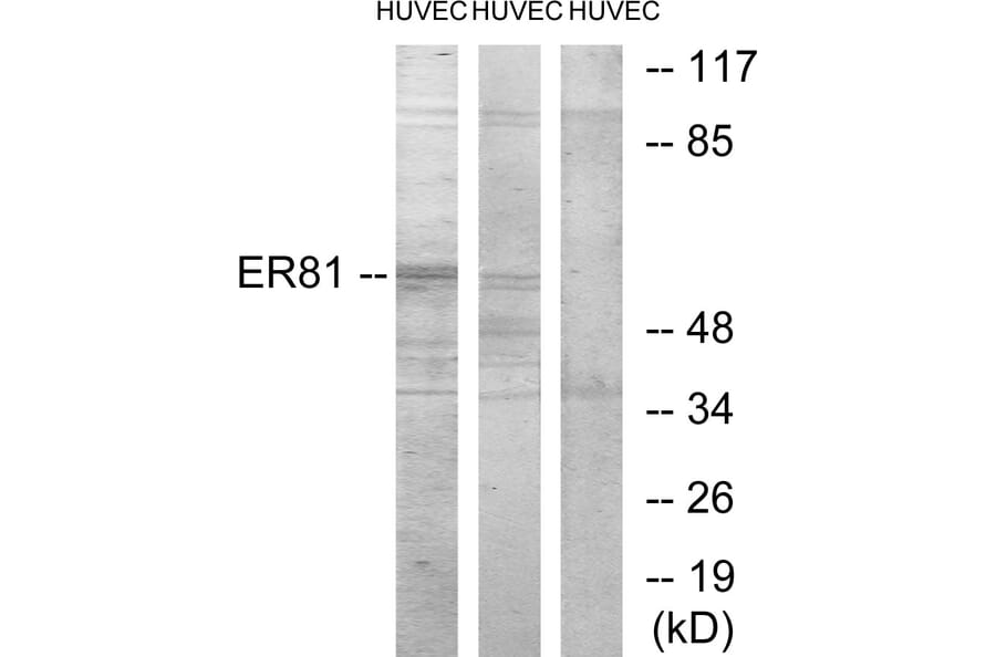 Western Blot - Anti-ER81 Antibody (C10667) - Antibodies.com