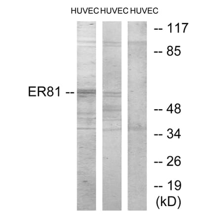 Western Blot - Anti-ER81 Antibody (C10667) - Antibodies.com