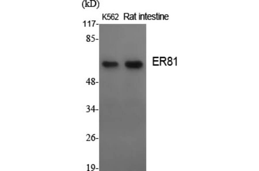 Western Blot - Anti-ER81 Antibody (C10667) - Antibodies.com