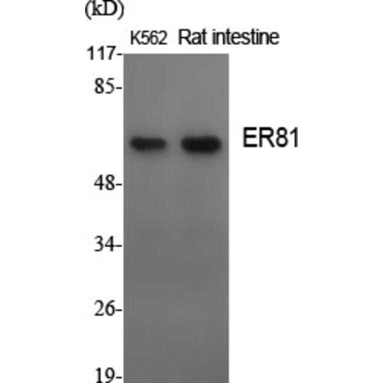 Western Blot - Anti-ER81 Antibody (C10667) - Antibodies.com