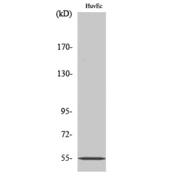 Western Blot - Anti-ER81 Antibody (C10667) - Antibodies.com