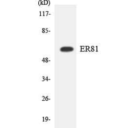 Western Blot - Anti-ER81 Antibody (R12-2755) - Antibodies.com