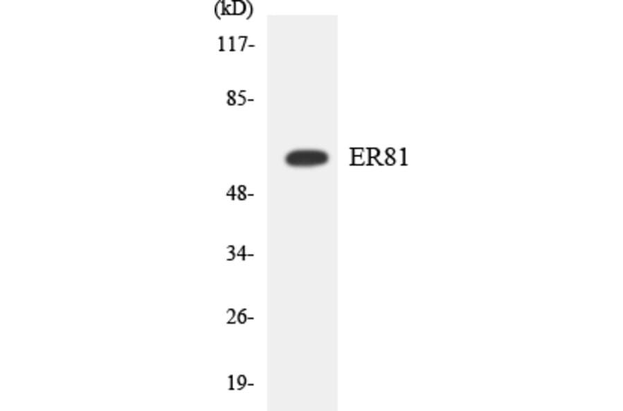 Western Blot - Anti-ER81 Antibody (R12-2755) - Antibodies.com