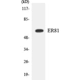 Western Blot - Anti-ER81 Antibody (R12-2755) - Antibodies.com