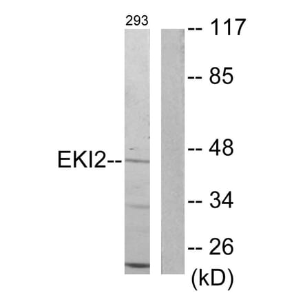 Western Blot - Anti-EKI2 Antibody (C11763) - Antibodies.com