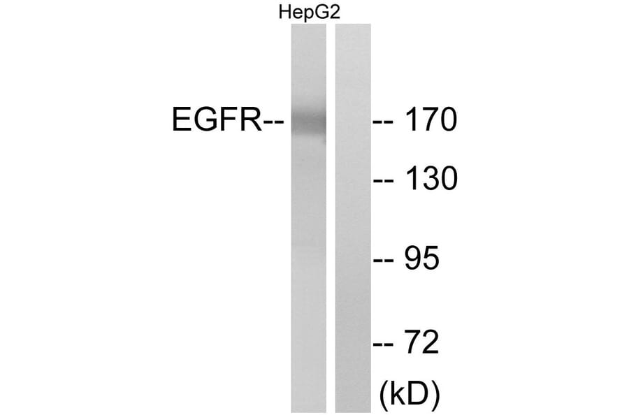 Western Blot - Anti-EGFR Antibody (B7062) - Antibodies.com
