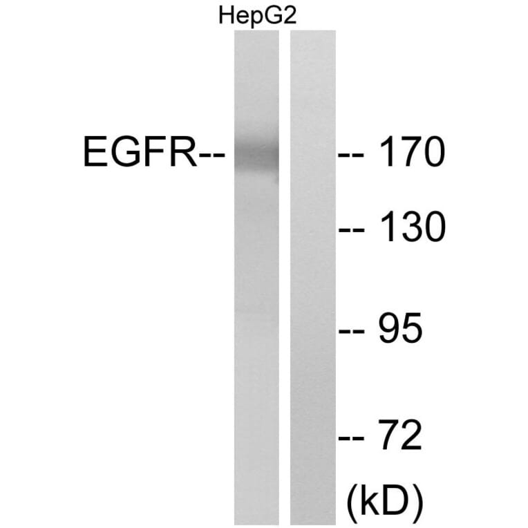 Western Blot - Anti-EGFR Antibody (B7062) - Antibodies.com