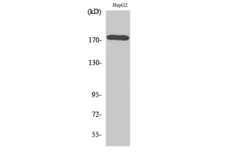 Western Blot - Anti-EGFR Antibody (B7062) - Antibodies.com