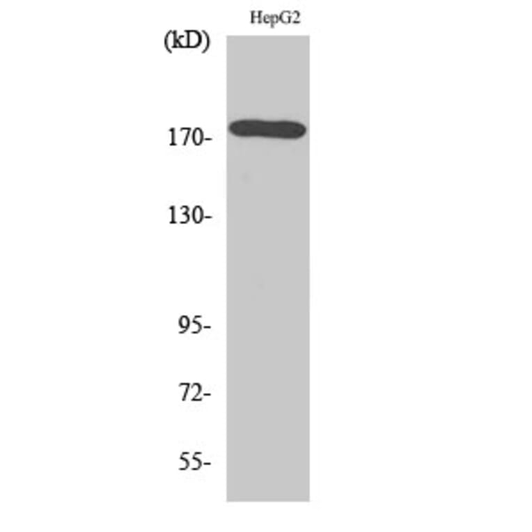 Western Blot - Anti-EGFR Antibody (B7062) - Antibodies.com