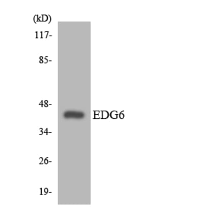 Western Blot - Anti-EDG6 Antibody (R12-2727) - Antibodies.com