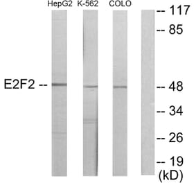 Western Blot - Anti-E2F2 Antibody (C11025) - Antibodies.com