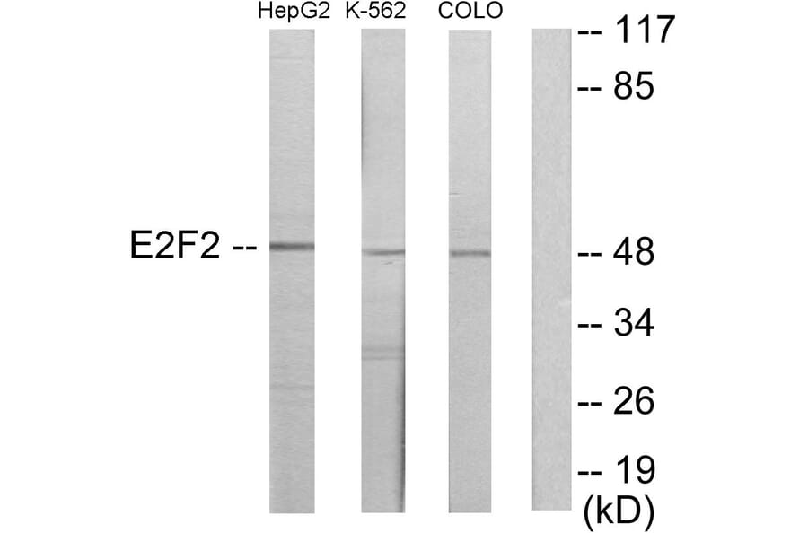 Western Blot - Anti-E2F2 Antibody (C11025) - Antibodies.com