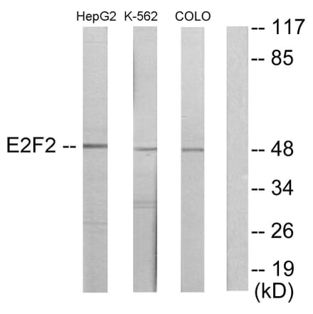 Western Blot - Anti-E2F2 Antibody (C11025) - Antibodies.com