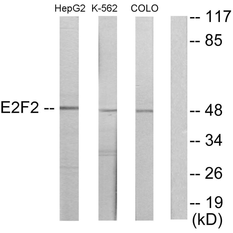 Western Blot - Anti-E2F2 Antibody (C11025) - Antibodies.com