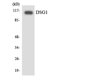 Western Blot - Anti-DSG1 Antibody (R12-2715) - Antibodies.com